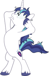 Size: 3200x4877 | Tagged: safe, artist:outlaw4rc, shining armor, pony, unicorn, the crystalling, absurd resolution, bipedal, cracked armor, simple background, solo, stressed, transparent background, vector