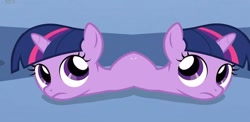 Size: 1066x519 | Tagged: safe, derpibooru import, twilight sparkle, budding, catdog, conjoined, filly, filly twilight sparkle, frown, looking up, mitosis, twiworm, two heads, wat, what has science done