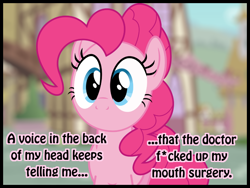 Size: 800x600 | Tagged: safe, pinkie pie, earth pony, pony, malpractice, no mouth, silly, solo