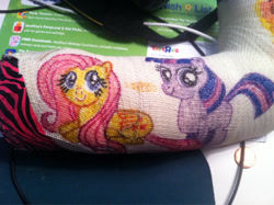 Size: 1024x765 | Tagged: safe, derpibooru import, fluttershy, twilight sparkle, pegasus, pony, cast, filly, injured, photo, traditional art