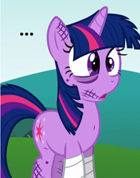 Size: 395x498 | Tagged: safe, derpibooru import, edit, edited screencap, screencap, twilight sparkle, feeling pinkie keen, ..., confused, cropped, image macro, injured, meme, messy mane, reaction image, solo