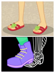 Size: 3106x4096 | Tagged: safe, edit, screencap, applejack, bulk biceps, accountibilibuddies, better together, choose your own ending, equestria girls, lost and found, broken bone, broken foot, feet, foot focus, legs, pictures of legs, x-ray, x-ray picture