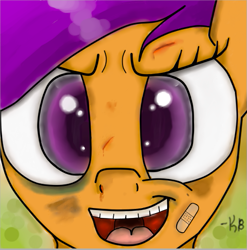 Size: 569x577 | Tagged: safe, artist:infinitussketch, scootaloo, bandage, black eye, blood, bruised, bust, portrait, solo