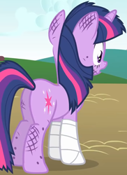 Size: 1064x1461 | Tagged: safe, derpibooru import, screencap, twilight sparkle, unicorn twilight, pony, unicorn, feeling pinkie keen, season 1, butt, dirty, female, injured, mare, plot, solo, twibutt